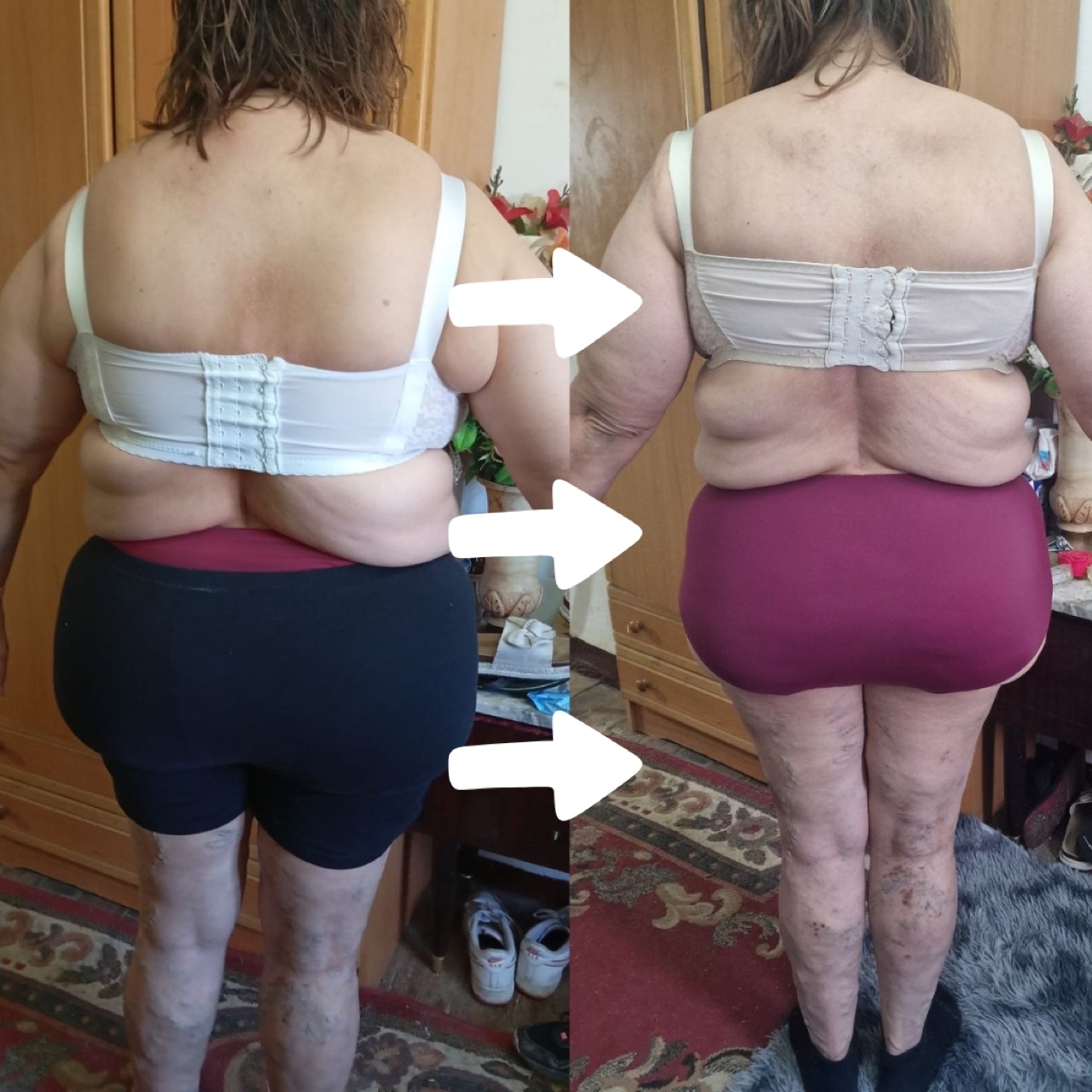 Transformación física, vista posterior